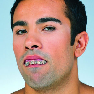 dentadura-nerd-aparelho